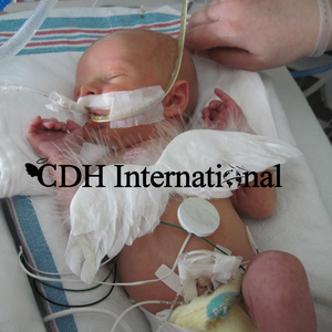 CDH International Logo