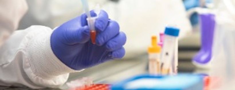 Alzheimers Research Australia