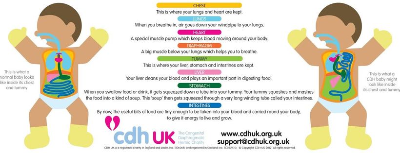 CDH UK